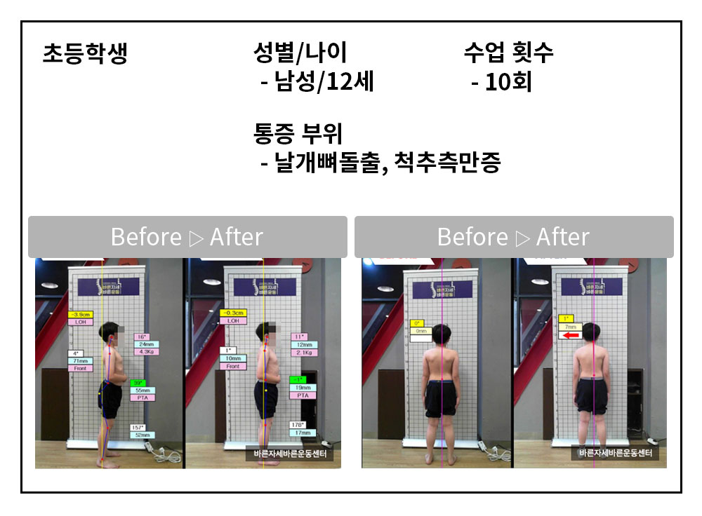 3BA 비포·애프터 사례