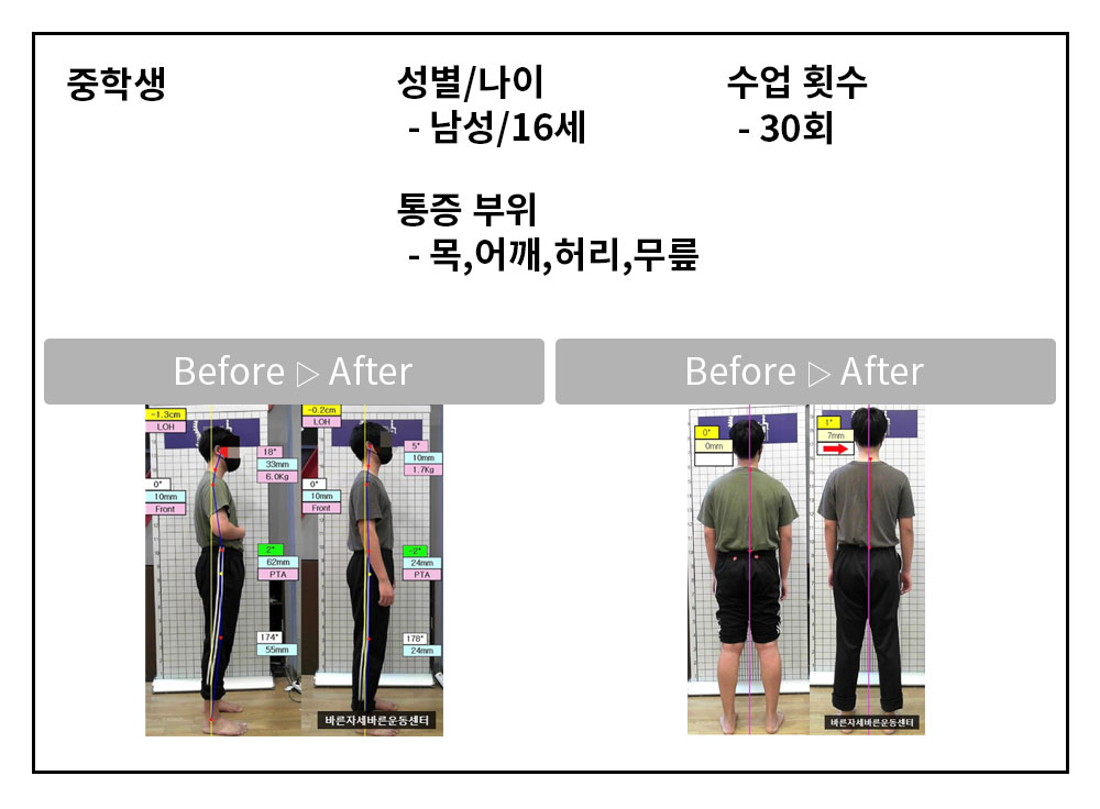 3BA 비포·애프터 사례