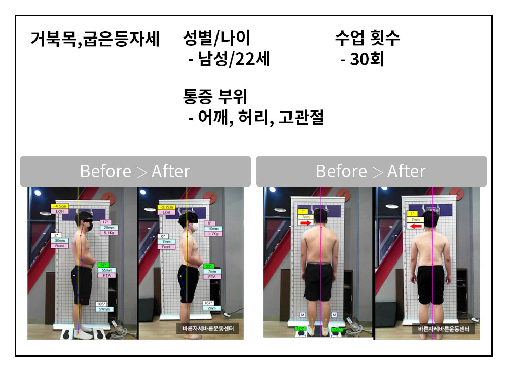 3BA 비포·애프터 사례