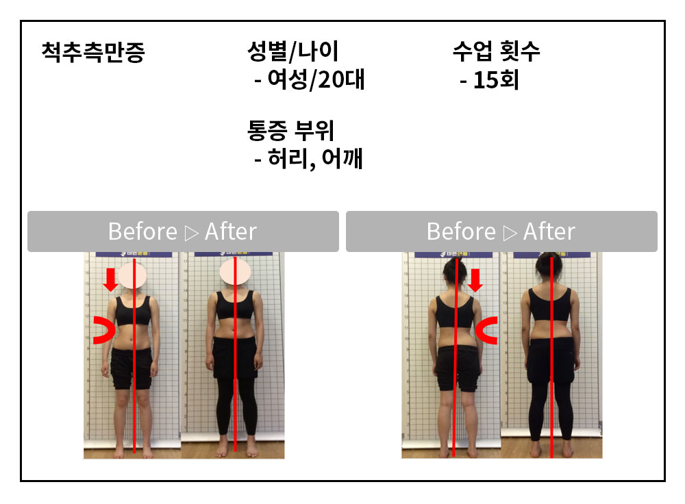 3BA 비포·애프터 사례