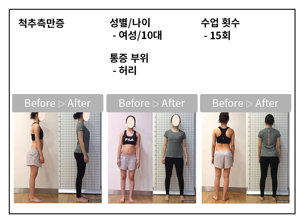 3BA 비포·애프터 사례