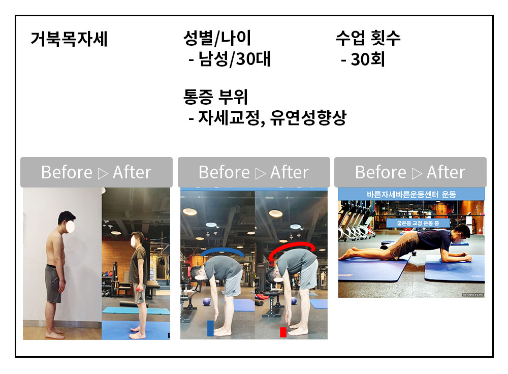 3BA 비포·애프터 사례