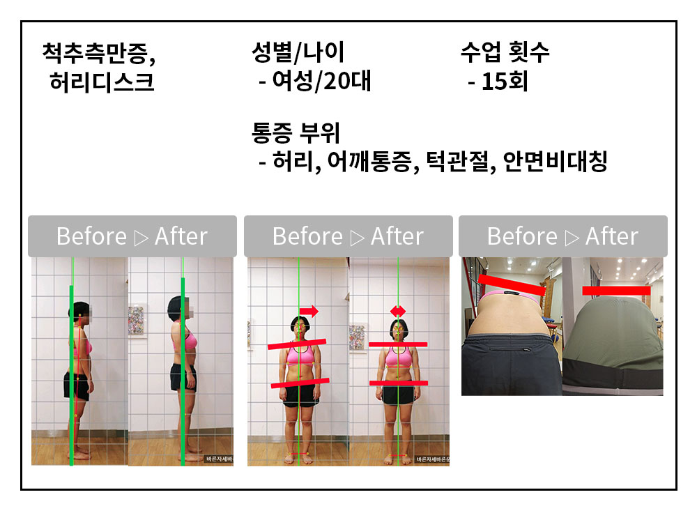 3BA 비포·애프터 사례