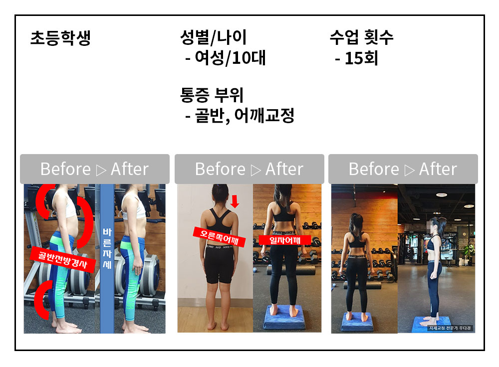 3BA 비포·애프터 사례