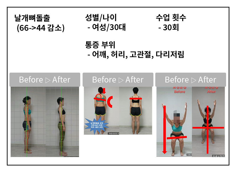 3BA 비포·애프터 사례