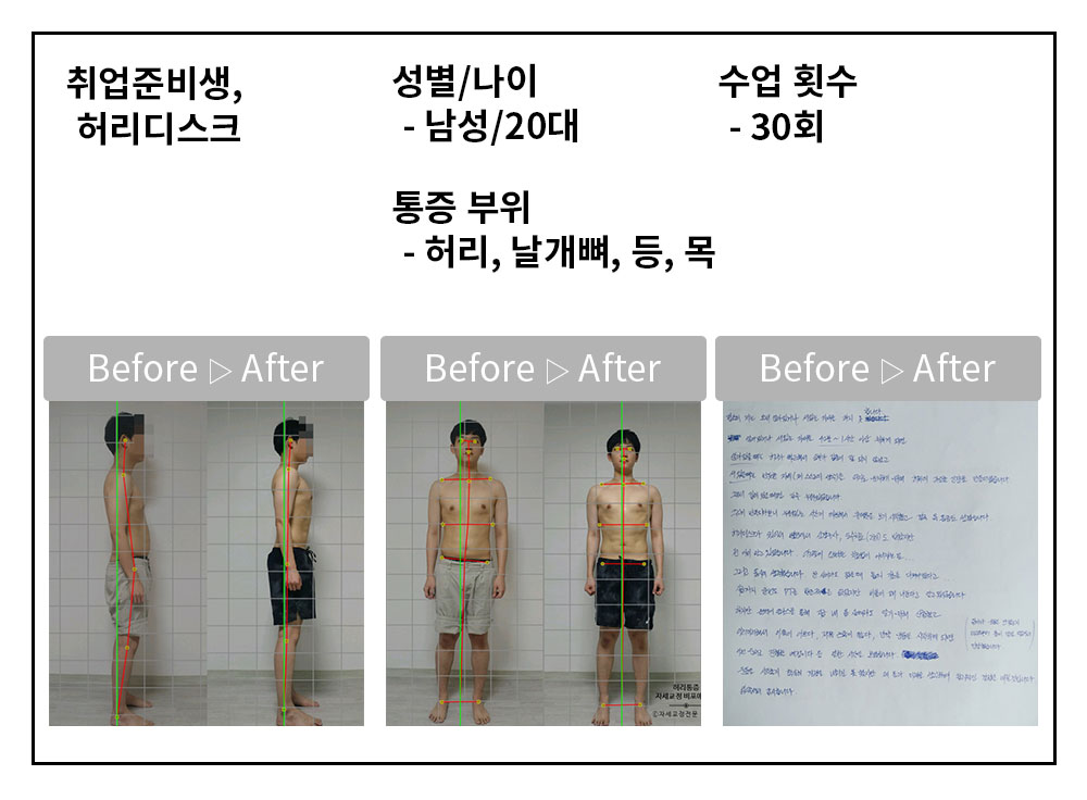 3BA 비포·애프터 사례