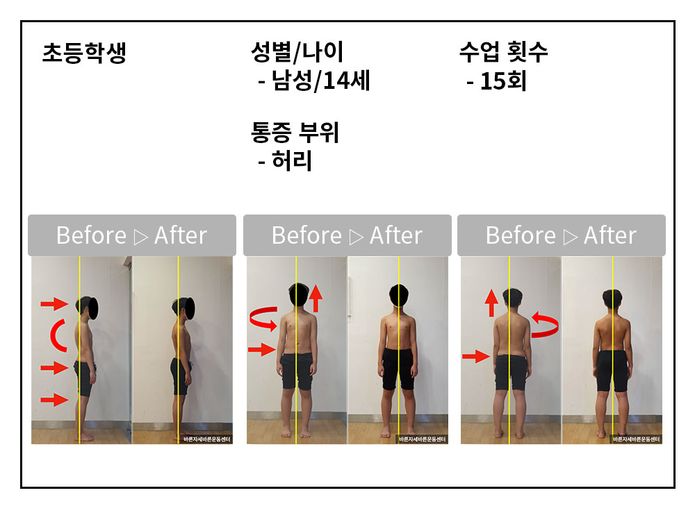 3BA 비포·애프터 사례
