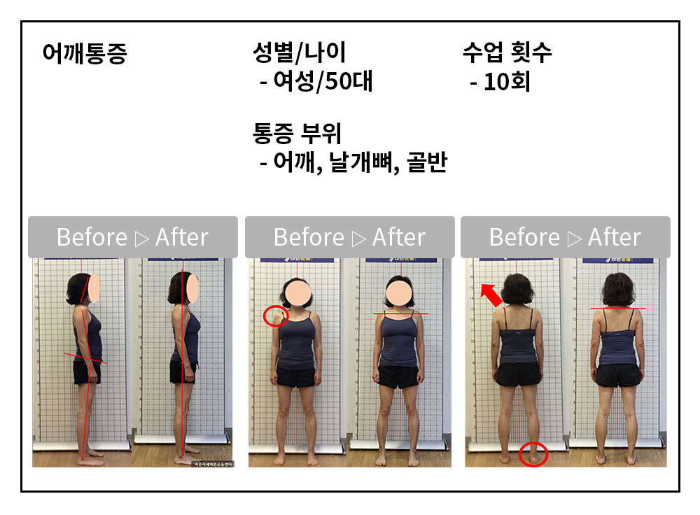 3BA 비포·애프터 사례