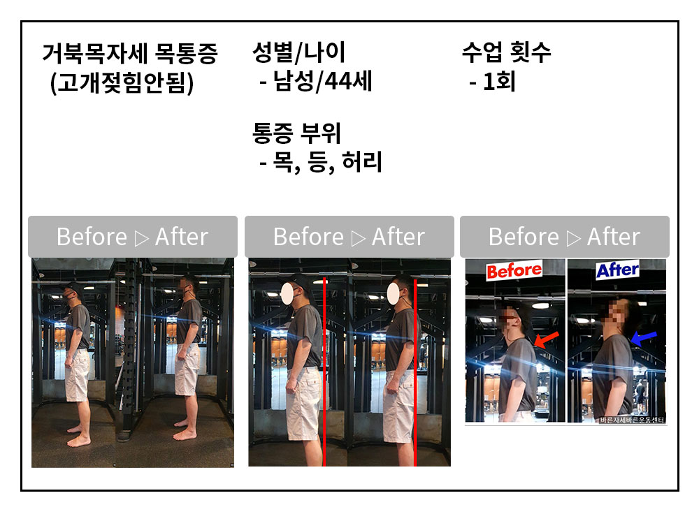 3BA 비포·애프터 사례
