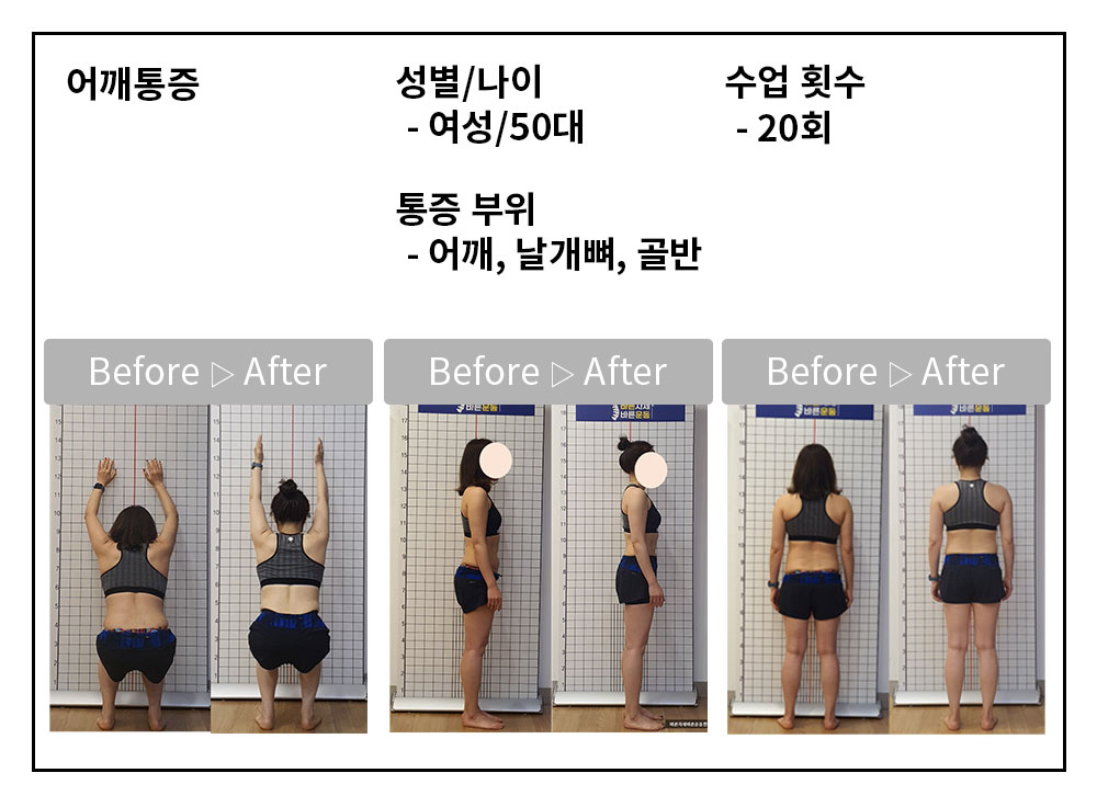 3BA 비포·애프터 사례